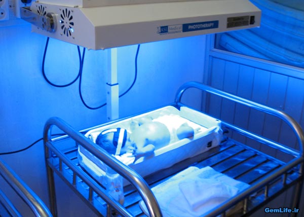 نوردرمانی برای درمان زردی نوزاد