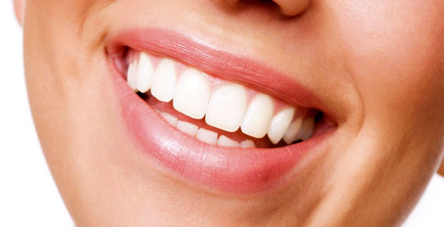 بلیچینگ دندان , سفید کردن دندان, هزینه بلیچینگ دندان
