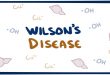 بیماری ویلسون چیست